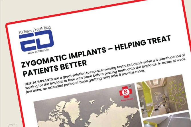 Are Zygomatic Dental Implants Safe?