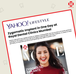 Yahoo Zygomatic Implants royal dental clinic