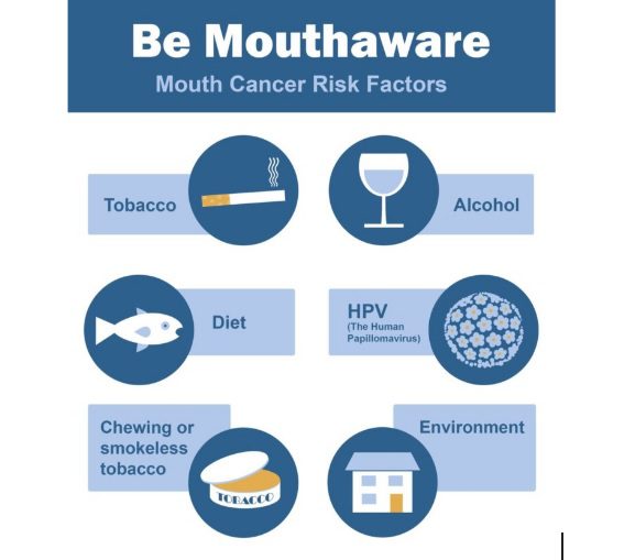 mouth aware - Fixed Teeth After Upper Jaw Cancer