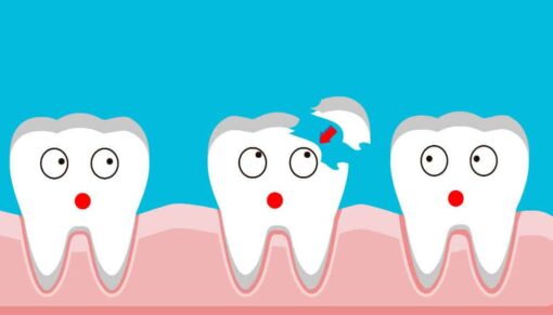 dental filling in time