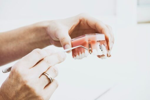 Single stage Dental implant
