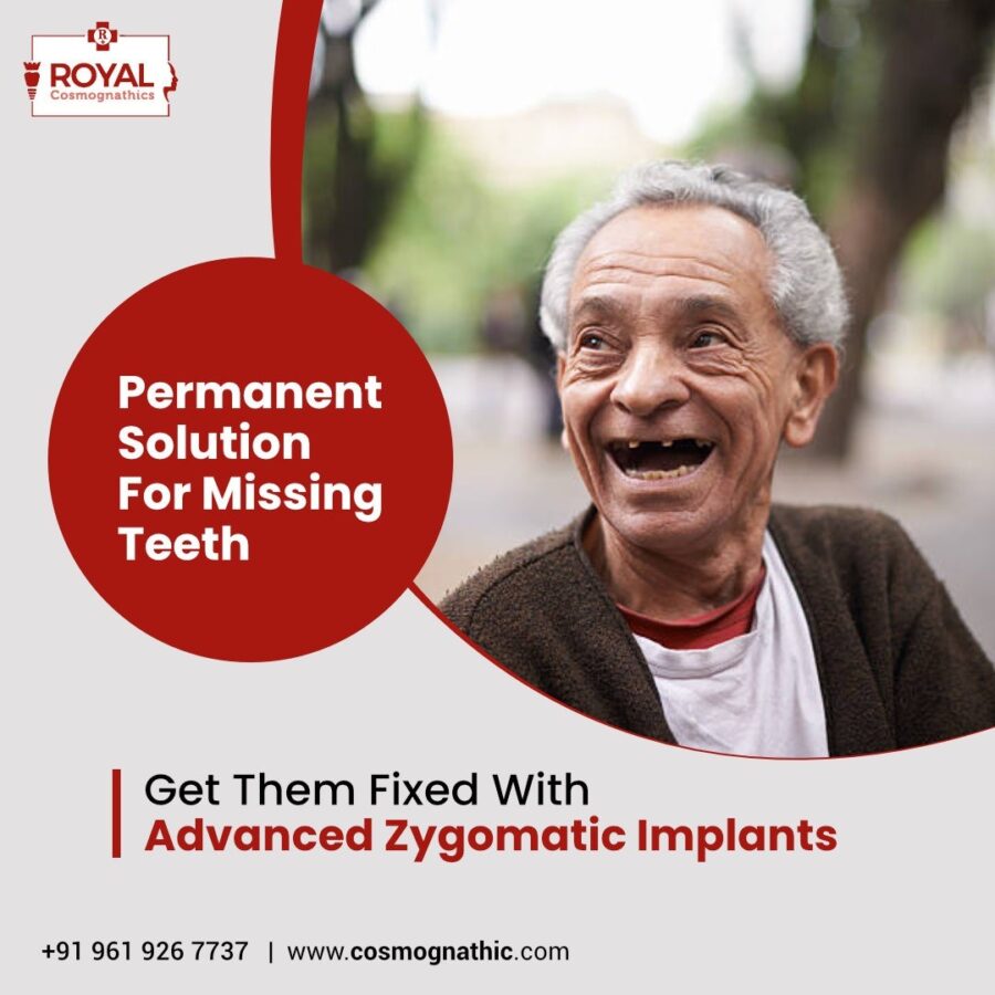 Zygomatic Implant