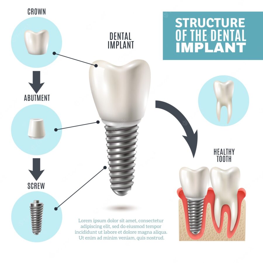 Why-is-Dental-Care-excluded-from-Social-Security?