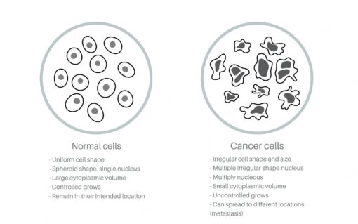 cancer cell
