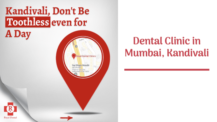 Dental Implant in Mumbai - Emergency Dentist in Kandivali East
