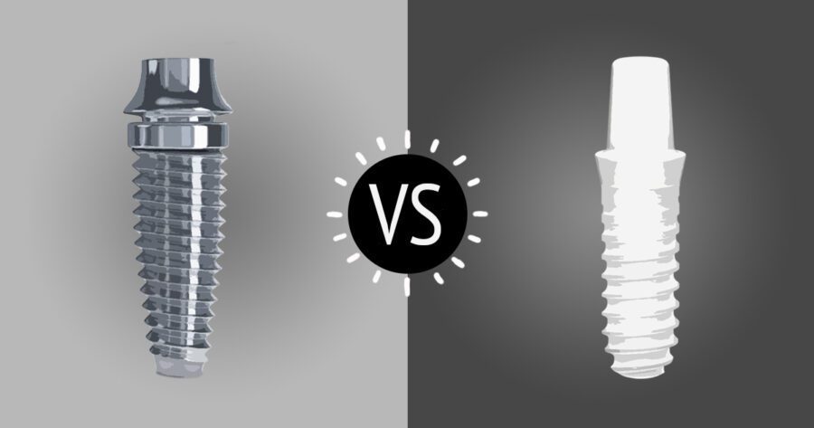 zirconia vs titanium dental implant