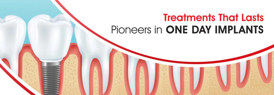 full mouth dental implants