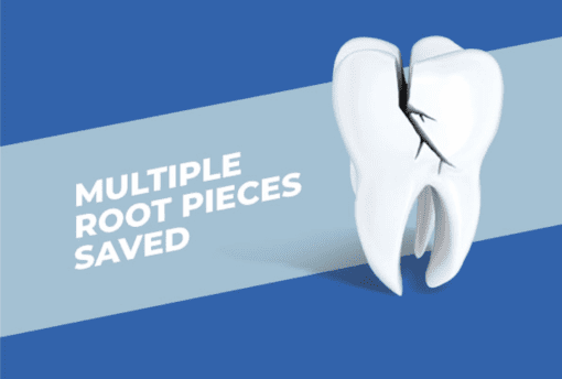Tooth Root pieces