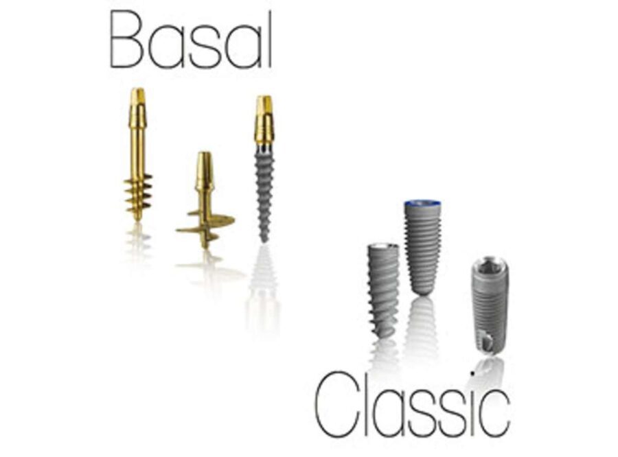 Zygomatic-Dental-Implants