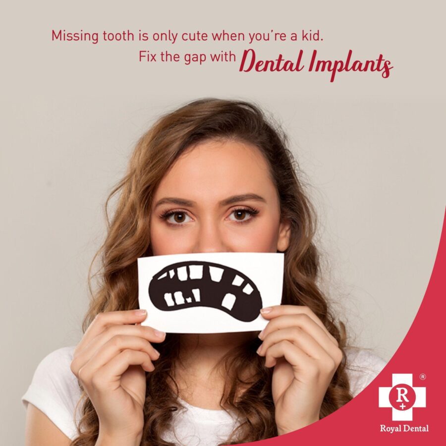 Dental-Implants-in-One-Da-Royal-Dental-Clinics