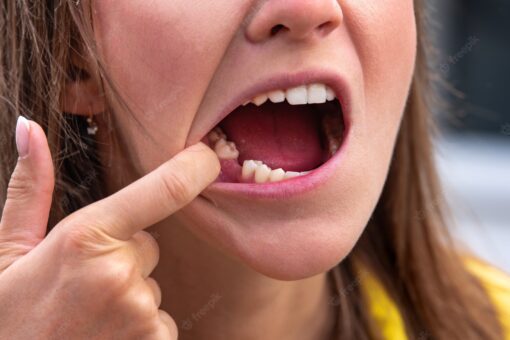 mouth openig missing teeth