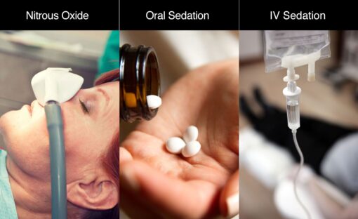 types of sedation anaesthesia sedation