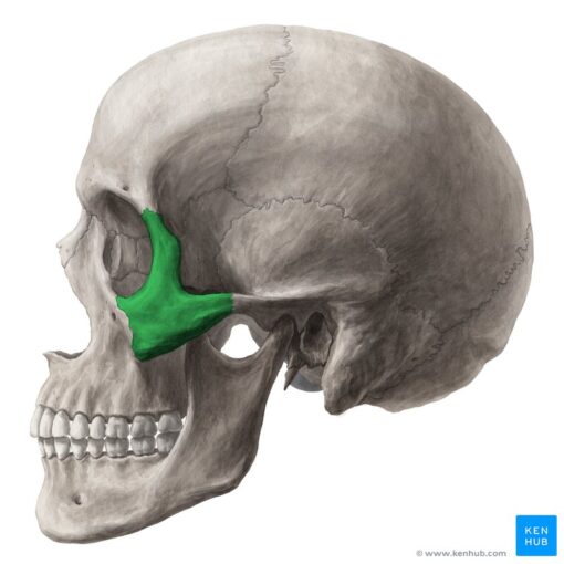 zygomatic implant bone
