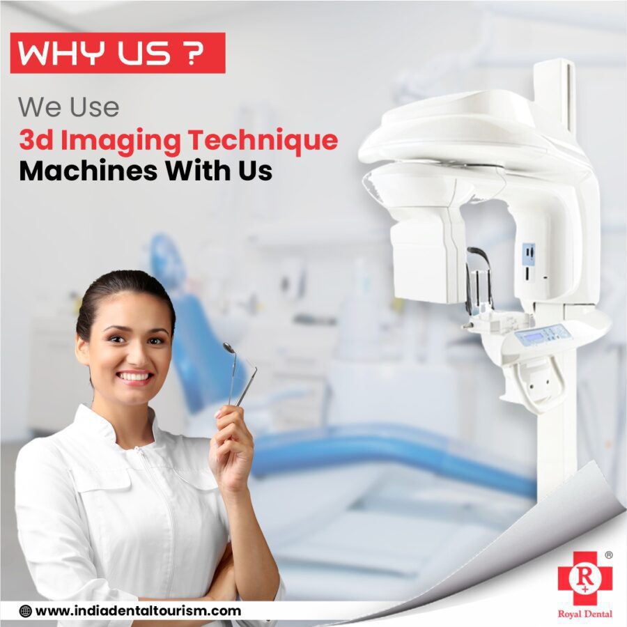 CBCT machine dental