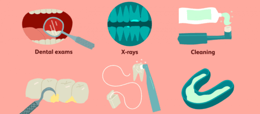 mouthguard