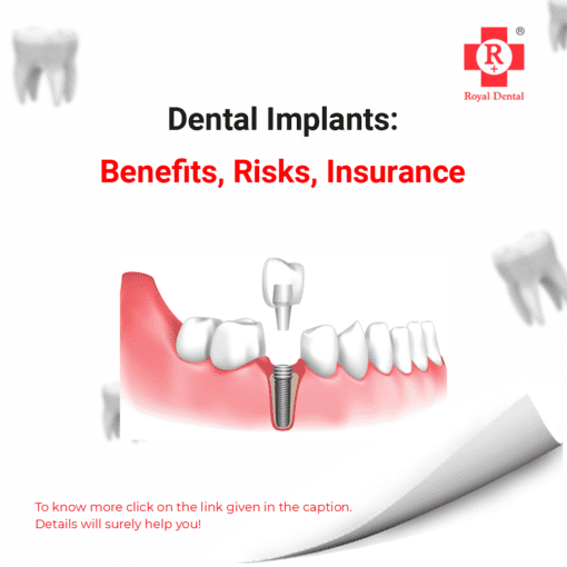 dental implant single day benefits