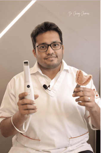 Digital-Dental-impression