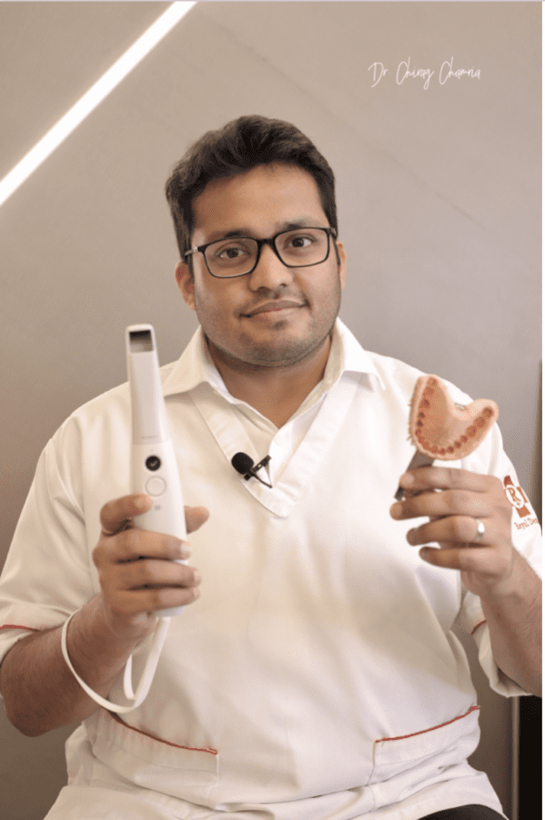 Digital-Dental-impression