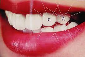 Cosmetic Dentistry