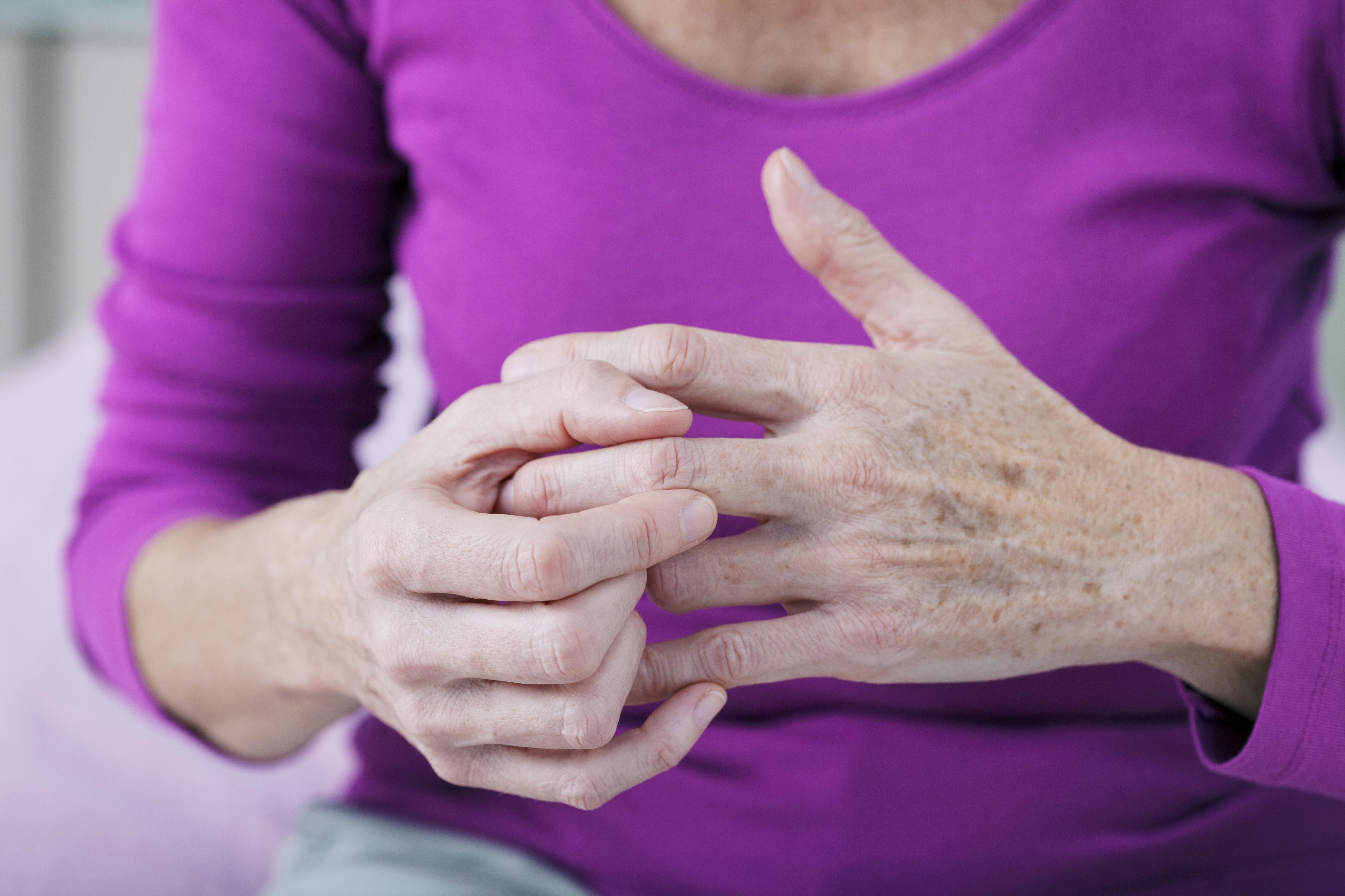 Arthritis and oral health