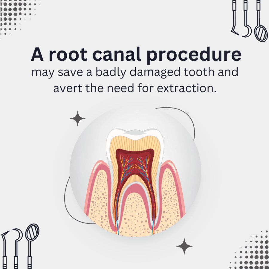Root Canal Crowns Treatment