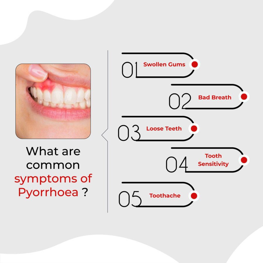 gum disease issue