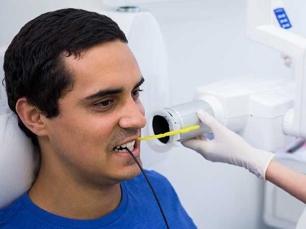 Intraoral x-rays