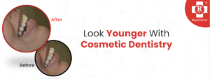 Cosmetic Dentistry & Smile Makeover