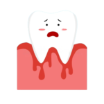bleeding gums