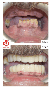 Royal Dental Clinic Kandivali East | Mumbai