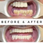 Premium dental experience in Thakur Village, Kandivali