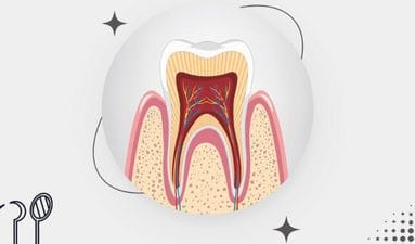 Dental Pain?