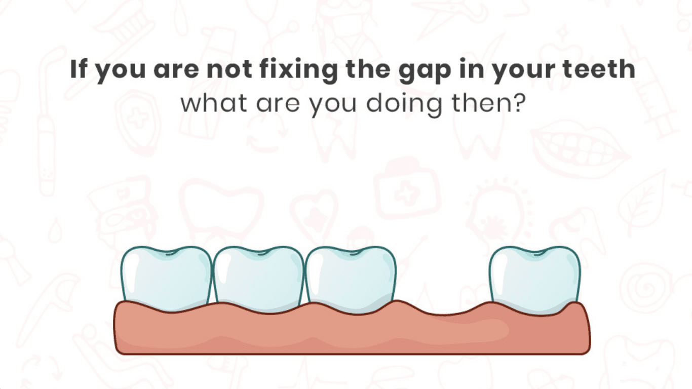 Royal Dental | One Day Dental Implants