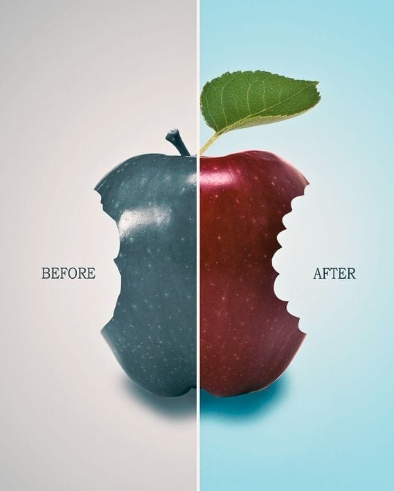 Royal Dental Clinic Kandivali East | Mumbai Before and After