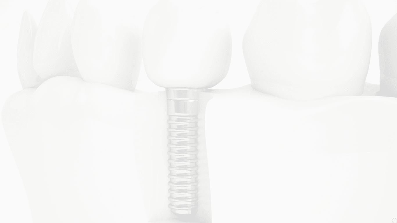 Royal Dental Clinic Kandivali East | Mumbai