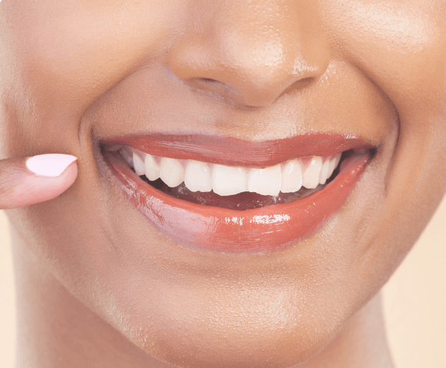 Dental Conturing | Smile Makeover