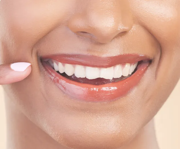Dental Conturing | Smile Makeover