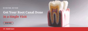 root canal painful? root canal in single day
