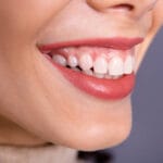 Side profile Beautiful Smile | Cosmetic Dentistry
