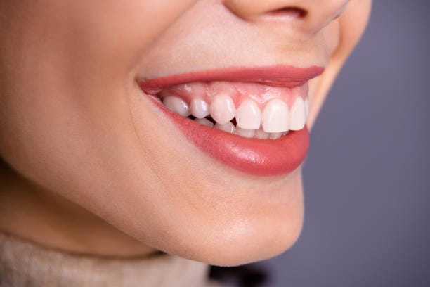 Side profile Beautiful Smile | Cosmetic Dentistry
