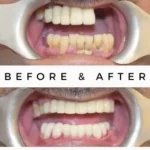 Royal Dental Clinics | Kandivali East Mumbai