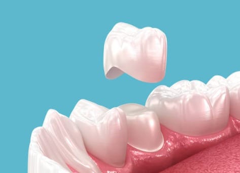 tooth crown