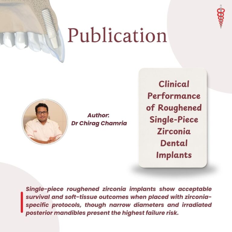 Zygomatic Dental Implant Publication
