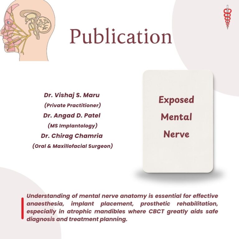 Exposed Mental Nerve Publication