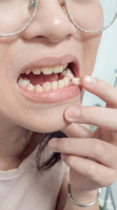 Solution For Teeth Mobility | One Day Dentistry Teeth Mobility Moving teeth