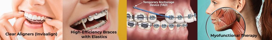 Bite Correction Treatment in Kandivali