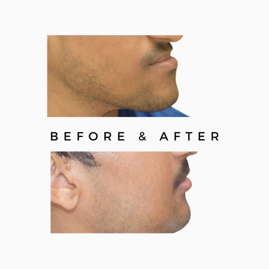 Jaw Surgery in Kandivali Mumbai