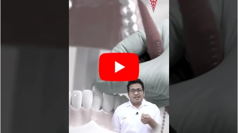 Metal-free Zirconia or Ceramic implants