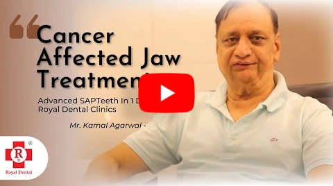 Cancer affected jaw treatment