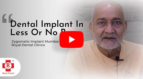 Same Day Fixed Teeth with Implant. Straight & Beautiful Teeth in 1 Day. Dental Implant